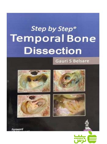 Step By Step Temporal Bone Dissection 2014 اندیشه رفیع